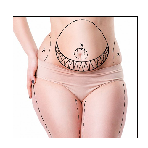 CHIRURGIE RÉPARATRICE