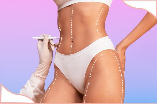 bodylift après sleeve en tunisie