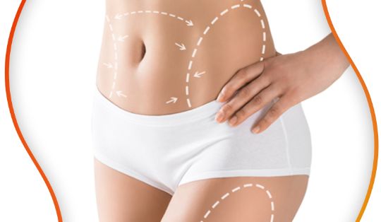 chirurgie de silouhette