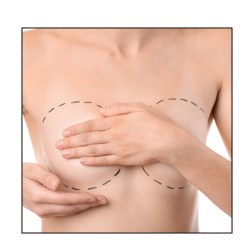 lipofilling mammaire cicatrice