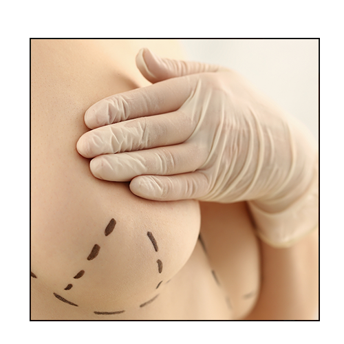 lipofilling mammaire prix