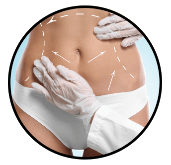 abdominoplastie tunisie