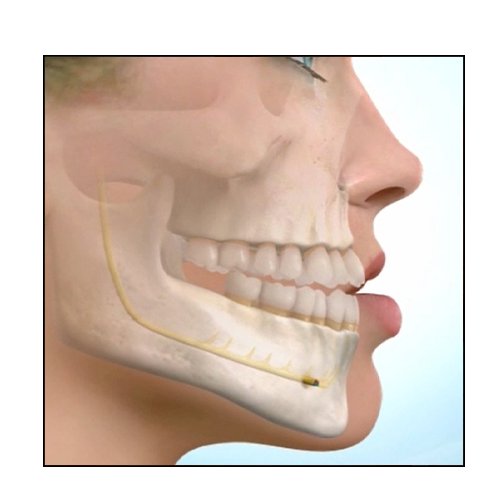 OPERATION MAXILLOFACIAL